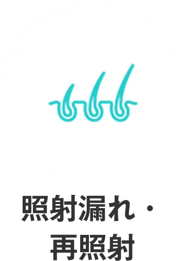 照射漏れ・再照射