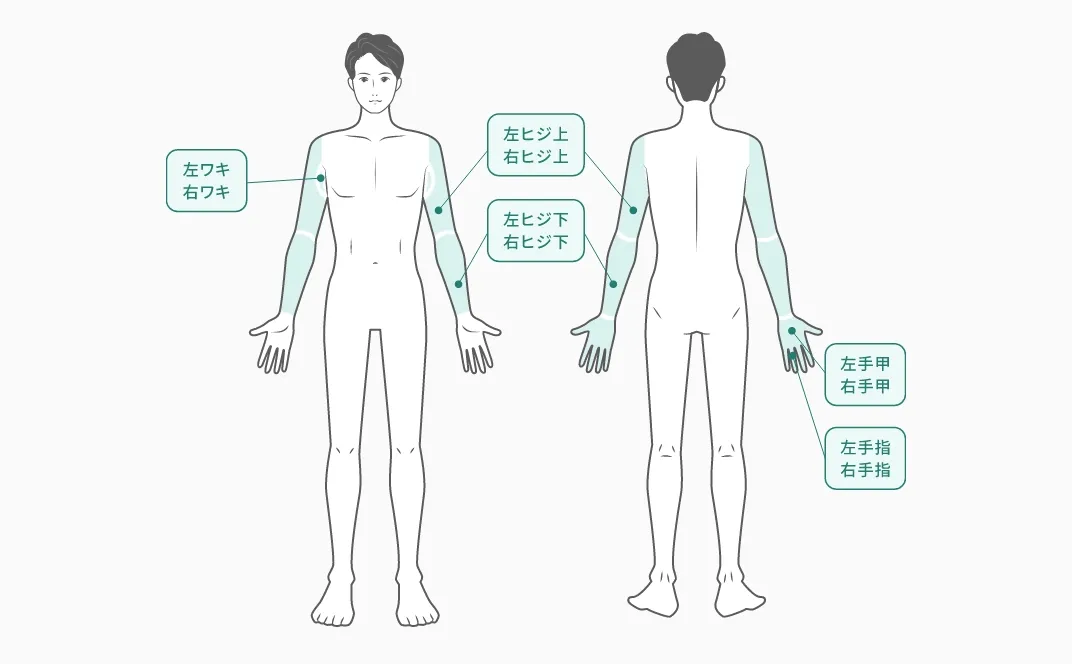 腕全体脱毛